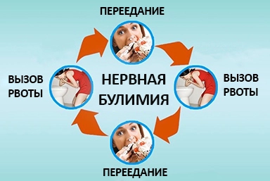 Лечение булимии в Аксае
